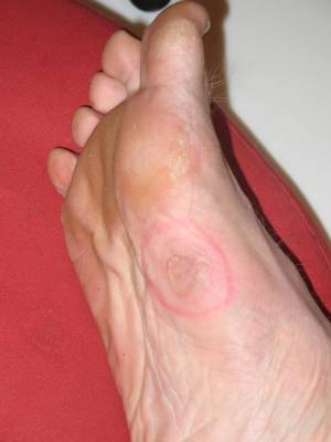 For the reader's benefit, I've "highlighted" the afflicted region.